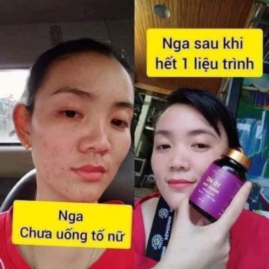 Feedback Tố Nữ Hoàng Sơn