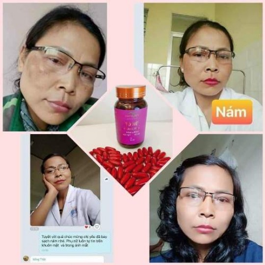 Feedback Tố Nữ Hoàng Sơn 
