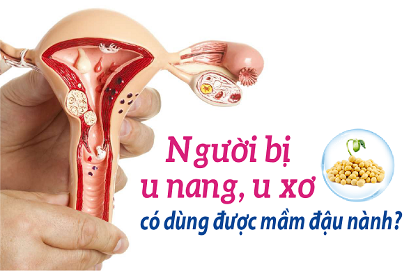 Có khối u có được sử dụng mầm đậu nành
