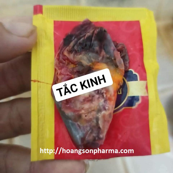 Feedback Tiêu viêm nữ tắc kinh 2 