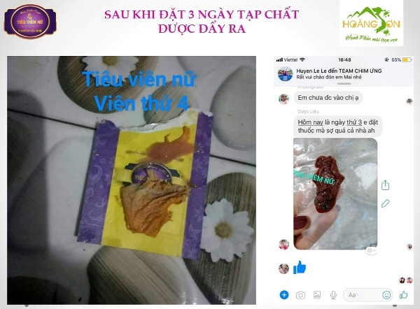 Feedback tiêu viêm nữ