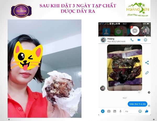 Feedback tiêu viêm nữ
