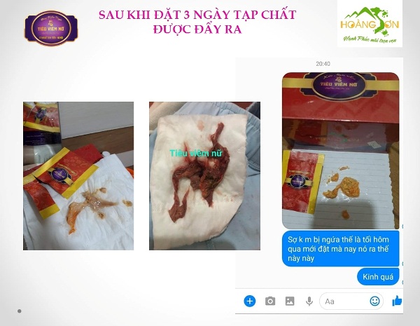 Feedback tiêu viêm nữ